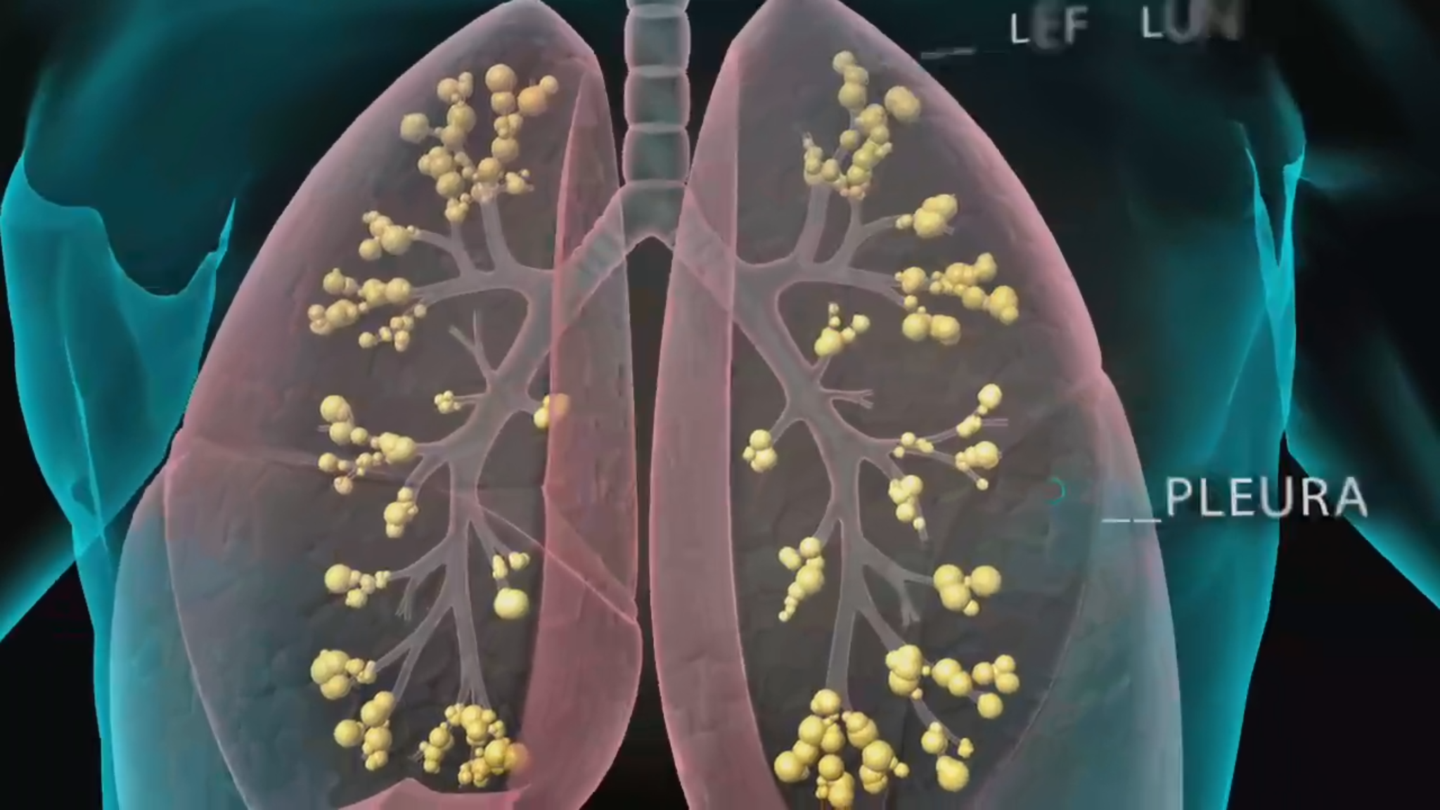 3D Medical Animation – Respiratory System – Centre for Informatics ...